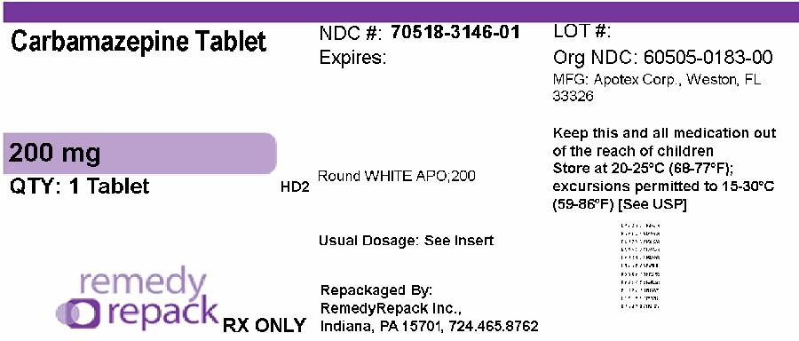 Carbamazepine